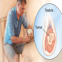 testicular-1